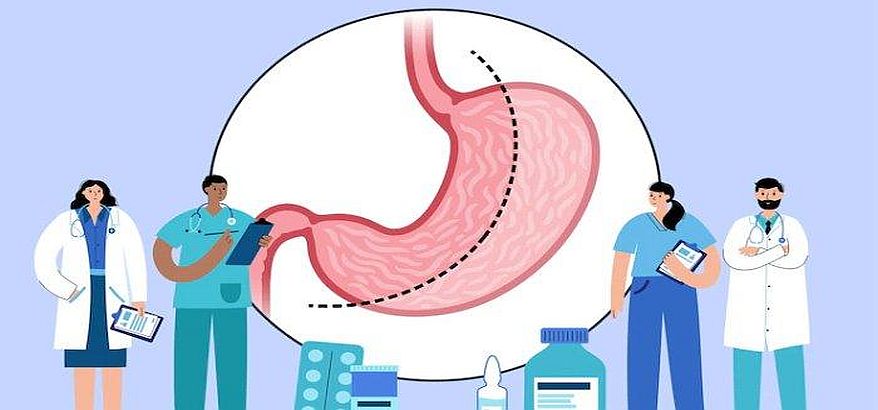 Inilah Fakta Seputar Operasi Bariatrik yang Dijalani Melly Goeslaw
