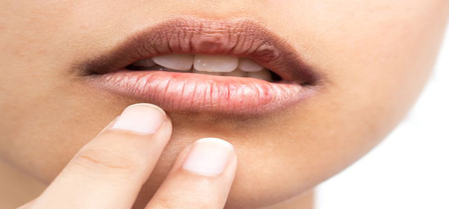4 Cara Tepat Mengatasi Bibir yang Menghitam dengan Bahan Alami